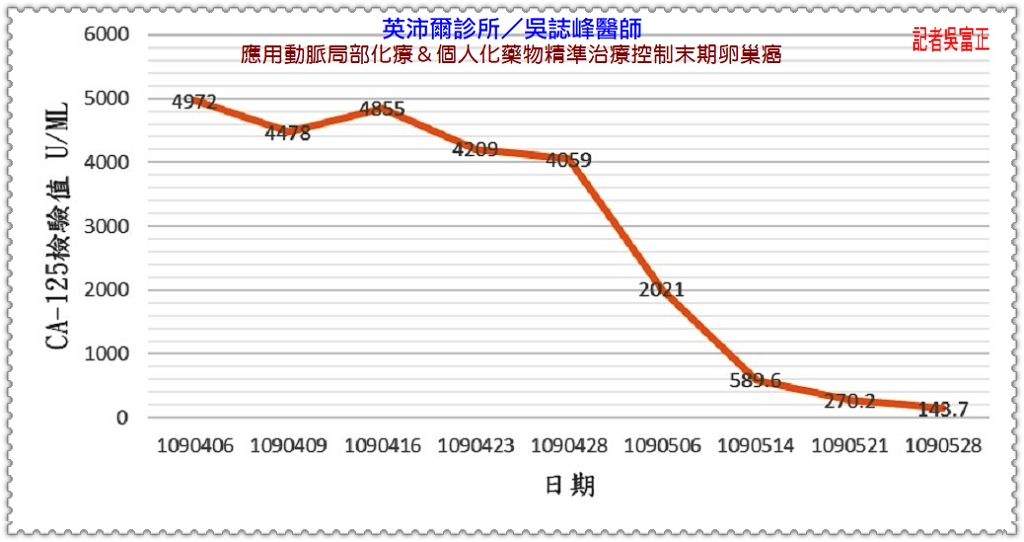 英沛爾診所／吳誌峰醫師應用動脈局部化療＆個人化藥物精準治療控制末期卵巢癌＠民生好報