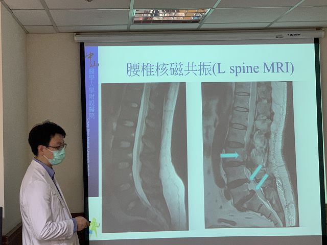 屁股麻痛到腳　原來是坐骨神經痛